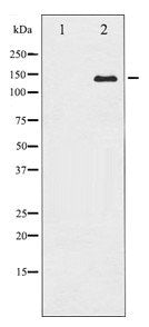 CASR Antibody