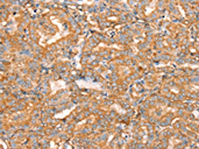 SLC16A8 Antibody