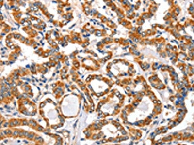 AIFM3 Antibody