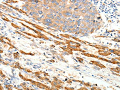 PTHLH Antibody