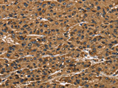 ATP7A Antibody
