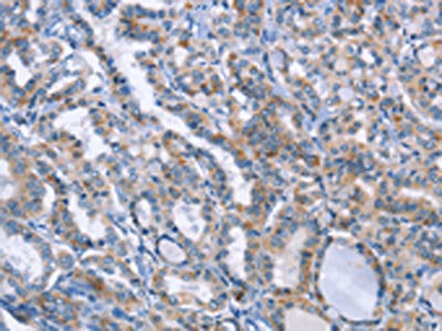 LRRK2 Antibody