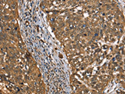 CSTB Antibody
