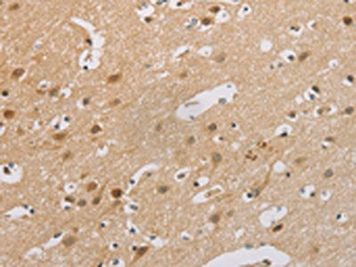 CDKN2A Antibody