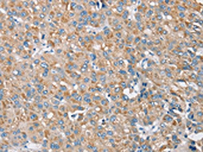 S100A9 Antibody