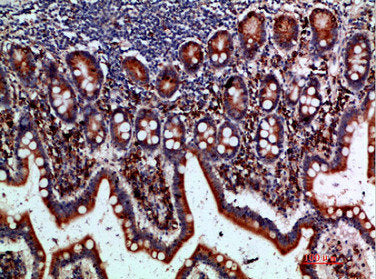 BTLA Antibody