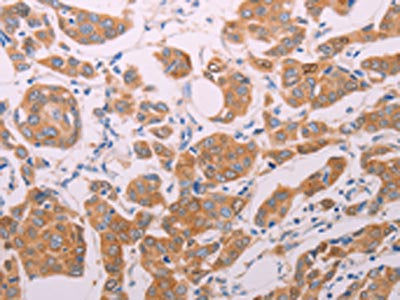 AGT Antibody