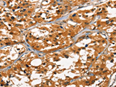 DEFA1/DEFA3 Antibody