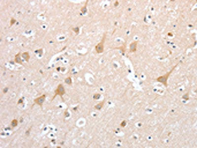 PCDHB16 Antibody
