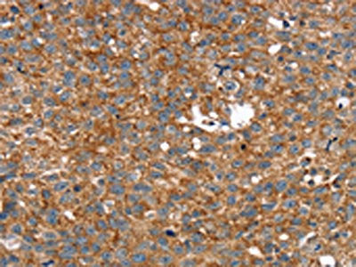 ARMC10 Antibody