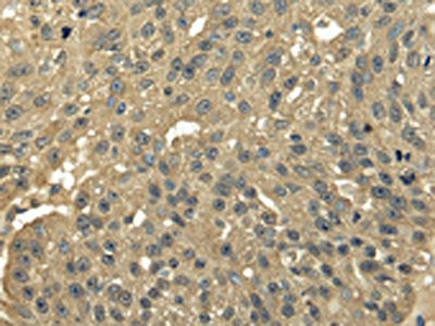 TFDP2 Antibody