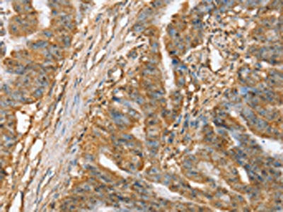 SLC41A2 Antibody
