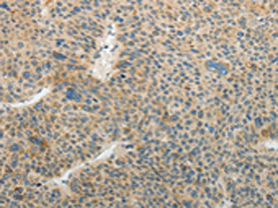 TFPI2 Antibody