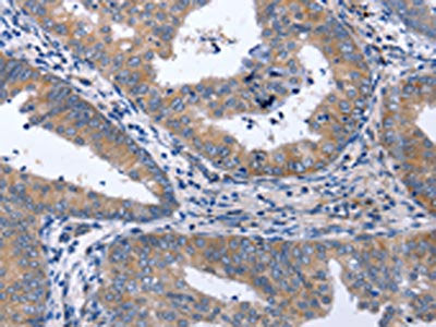 NPPB Antibody