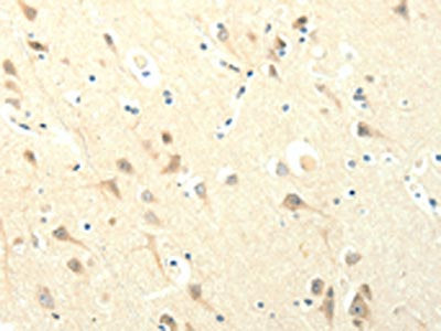 SYT5 Antibody