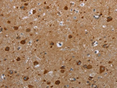 HIF1AN Antibody