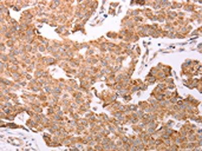 SMAD5 Antibody