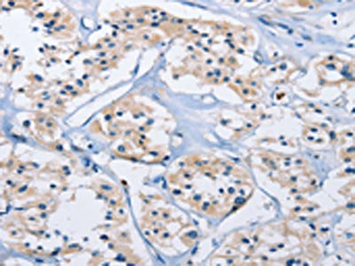 CARD14 Antibody