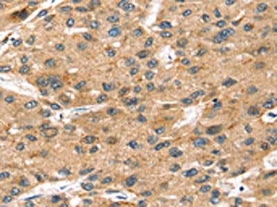 SORT1 Antibody