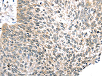 TLK2 Antibody