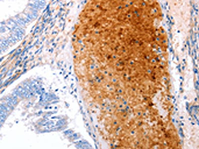 GRB10 Antibody