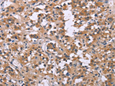 FGFR2 Antibody