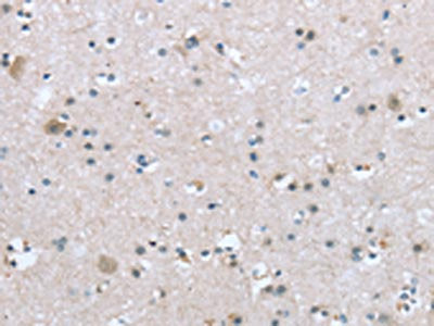 TRPM3 Antibody