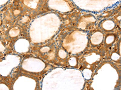 TMPRSS11F Antibody