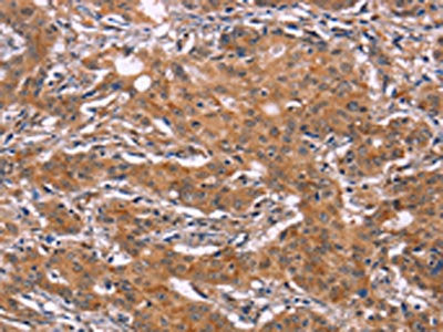 NR4A2 Antibody