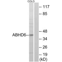 ABHD6 Antibody