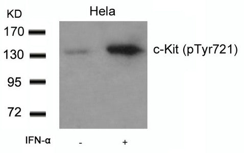 Phospho-KIT (Tyr721) Antibody