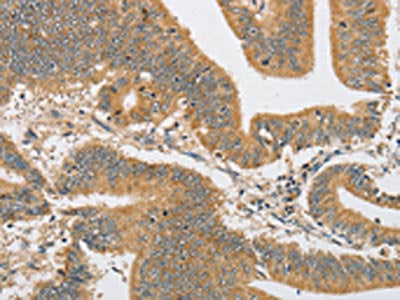 ARHGAP15 Antibody