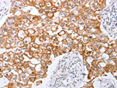 TNFAIP1 Antibody