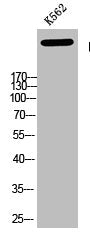 Phospho-ATM (Ser1981) Antibody