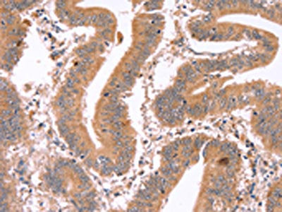 ICAM5 Antibody