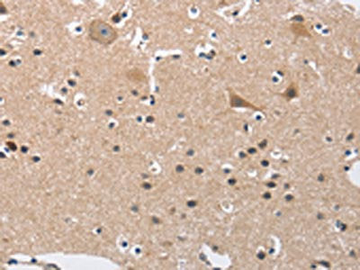 BUB1 Antibody