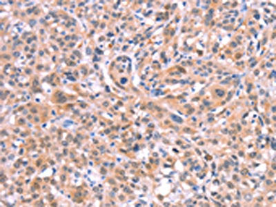 BMPR2 Antibody