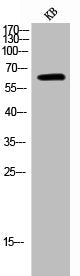 Phospho-PRKAA1/PRKAA2 (T183/172) Antibody