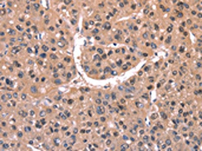 EXTL1 Antibody