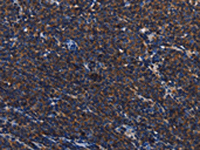 PTPRC Antibody