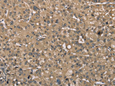 SASH1 Antibody