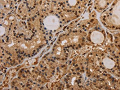 KCNN4 Antibody