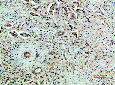 KDR Antibody