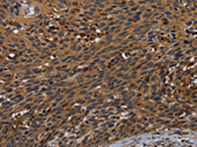PCDHB15 Antibody