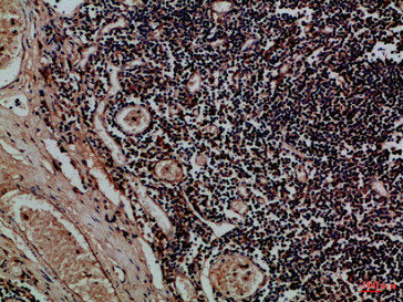 KIR2DL5A/KIR2DL5B Antibody