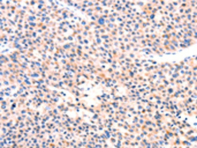 APBA2 Antibody