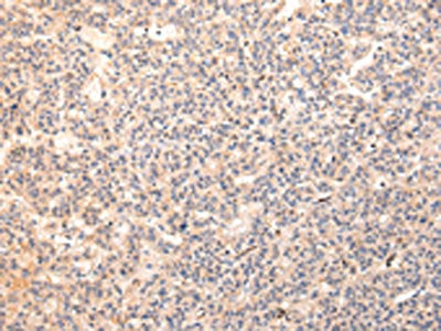 ZPR1 Antibody
