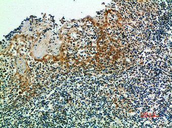 IRF3 Antibody
