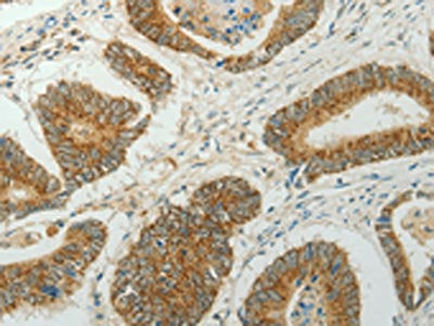 CCND1 Antibody