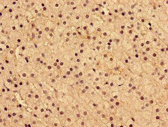 AIP Antibody